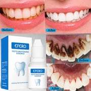EFERO Teeth Whitening Essence - 10ml Murukali.com
