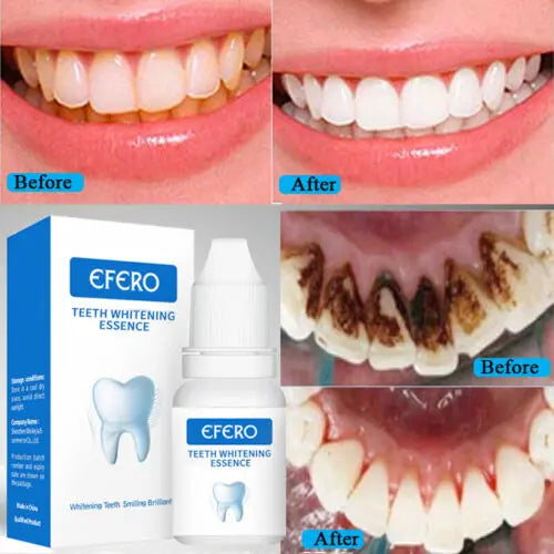 EFERO Teeth Whitening Essence - 10ml Murukali.com
