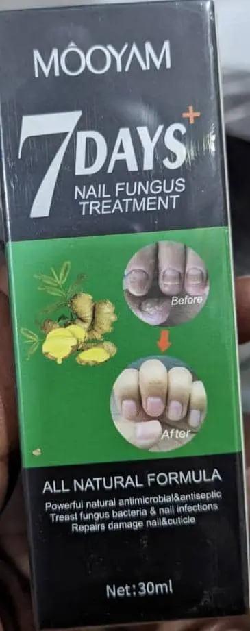 Mooyam 7 Days+ Nail Fungus Treatment in 30ML Murukali.com