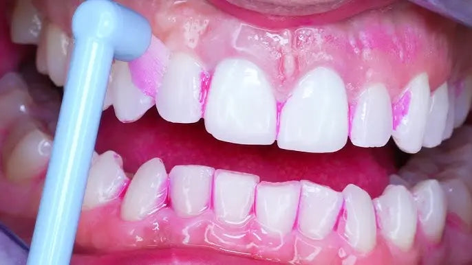 Wisdom Interspace Brushes Soft Murukali.com